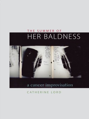 cover image of The Summer of Her Baldness